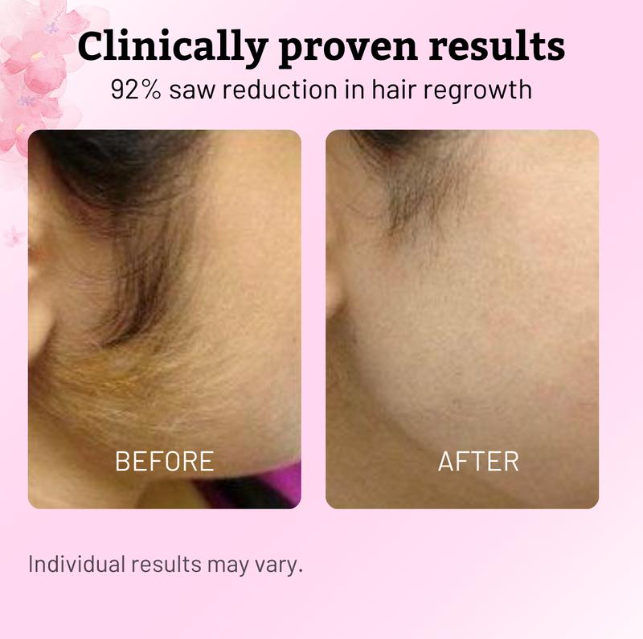 Roselle & Roots - Cyperus Rotundus Oil for Hair Removal