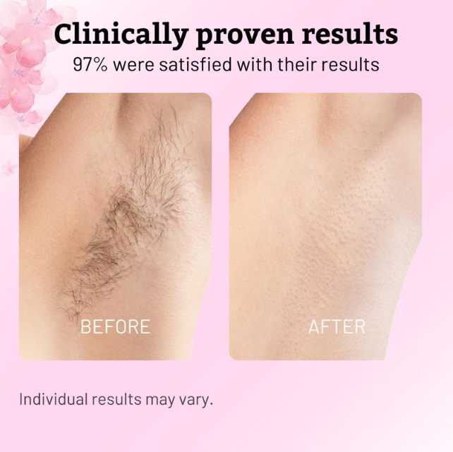 Roselle & Roots - Cyperus Rotundus Oil for Hair Removal